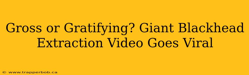 Gross or Gratifying? Giant Blackhead Extraction Video Goes Viral